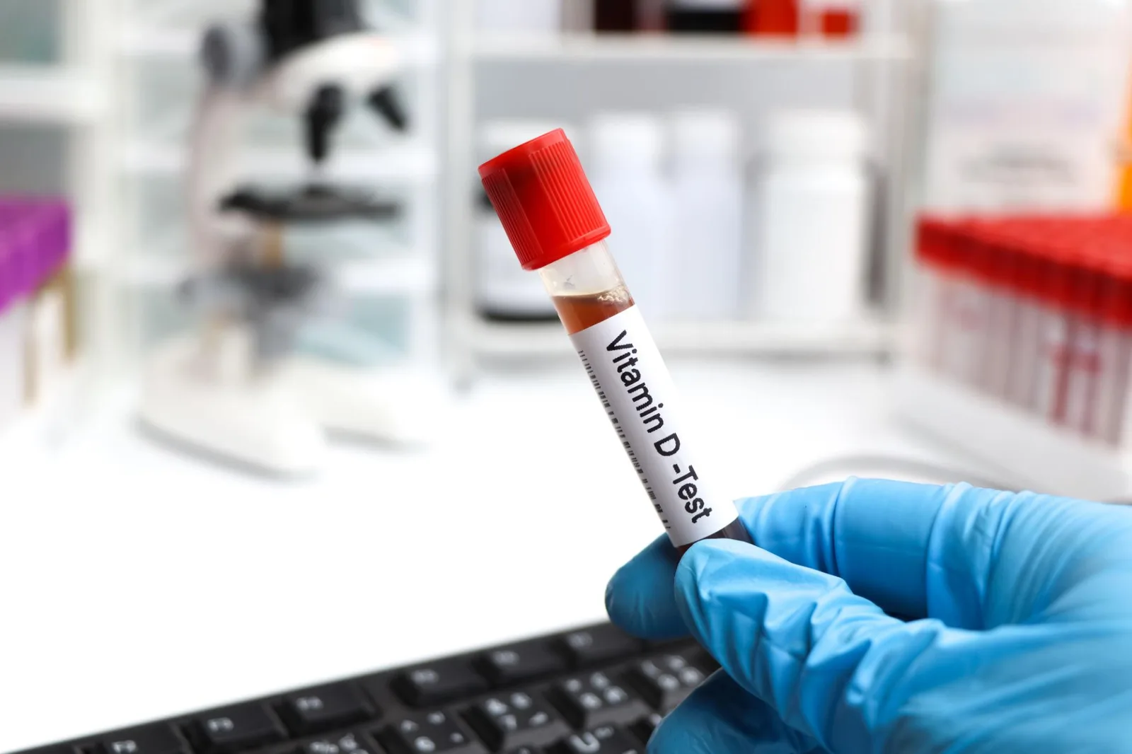 Healthcare professional preparing a diagnostic blood draw
